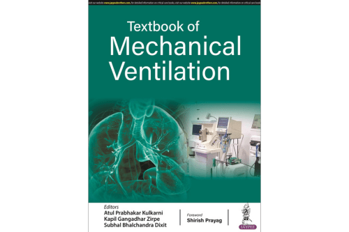 Ventilation